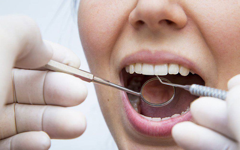 Devido ao grande desgaste e rompimento na boca, típico de obturações dentárias feitas com uma mistura de metais ou compostos de pó de vidro e cerâmica frequentemente precisam de reparação.